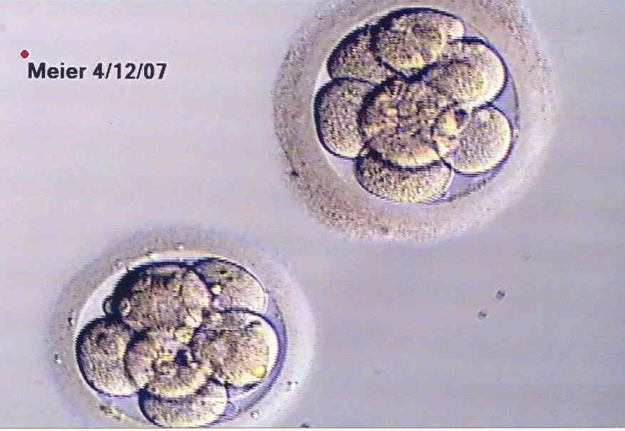 Children born from frozen embryos weigh more and do better than those born after fresh transfer  