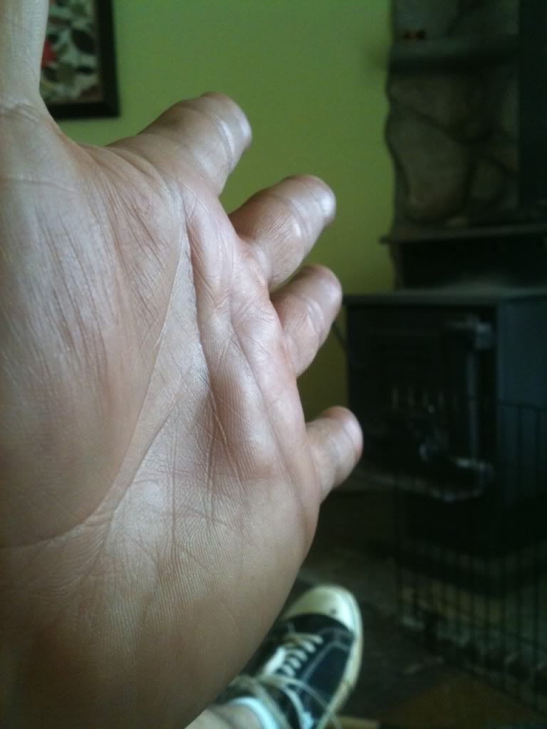 hand pain during pullups CrossFit Discussion Board